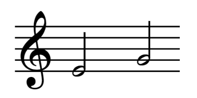 melodic interval